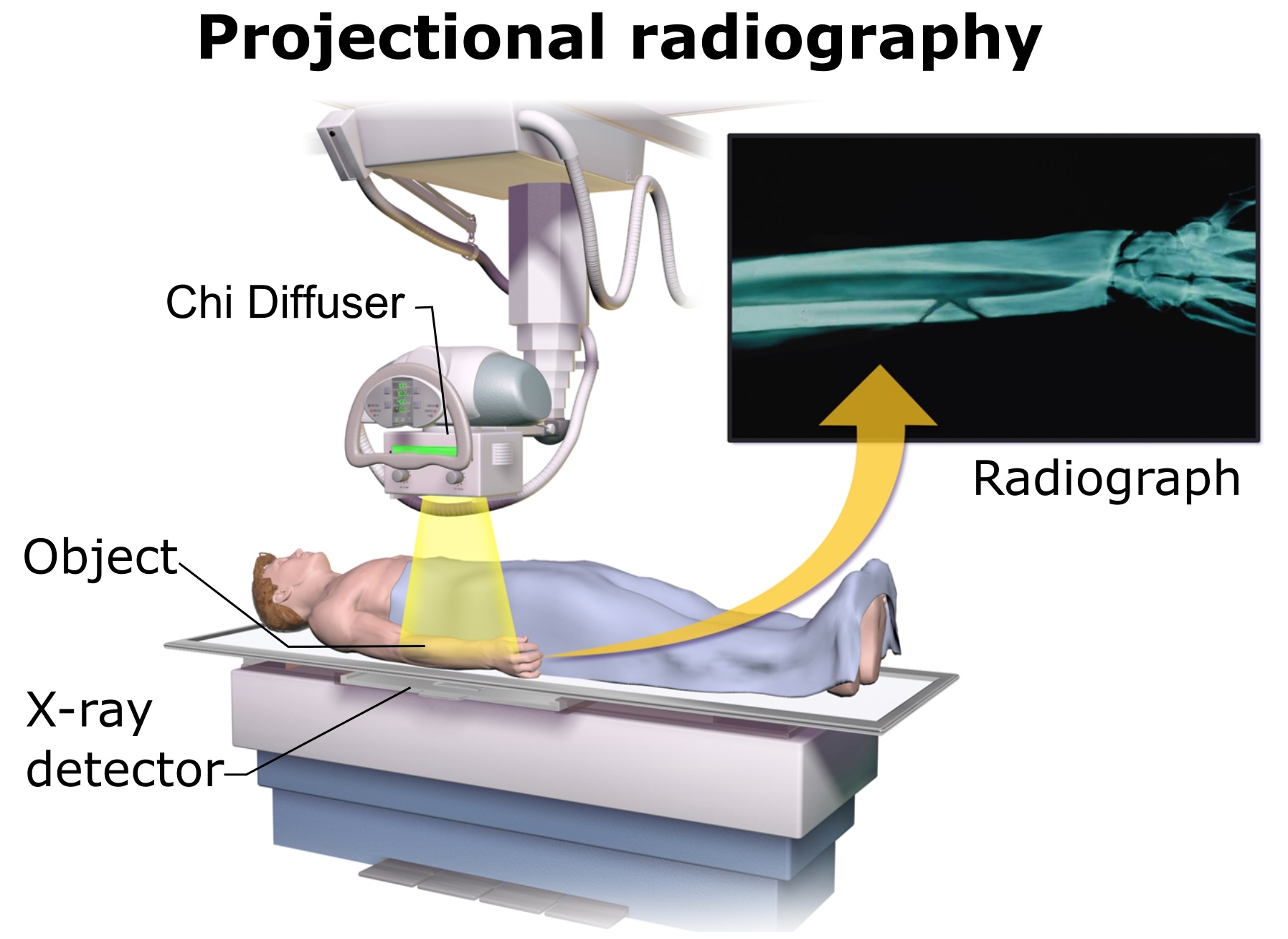 Real Radiographic Real Life Fantasy: Microwaves and X-Rays - Brent Weeks